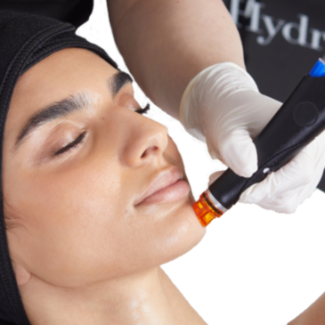 Hydrafacial™