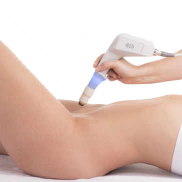 Exilis Ultra Femme 360, BTL